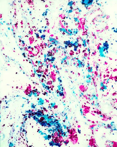 Tshirt Printing By Discharge Printing Method